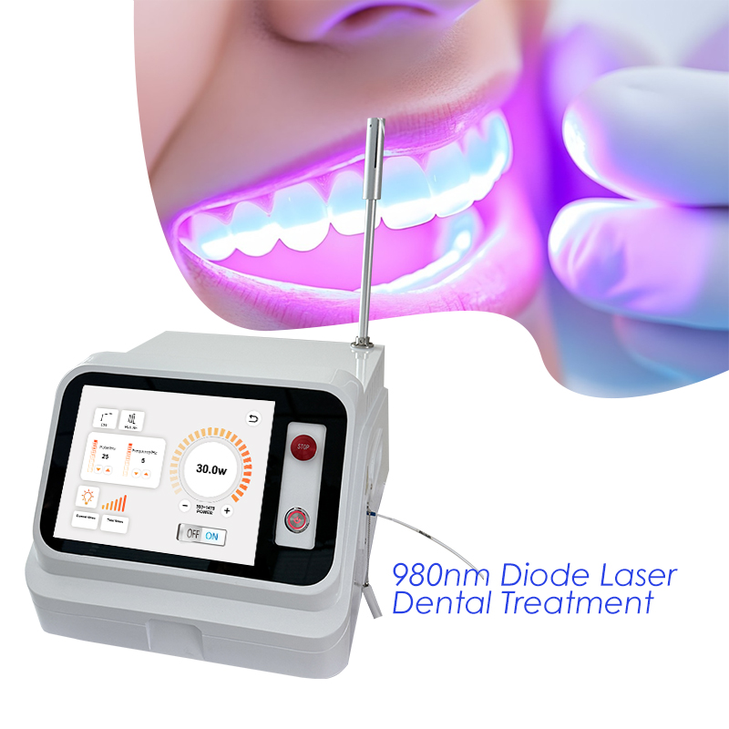 2024 Hot Sale Dental Soft Tiss - огляд і ціна Teeth Whitening With Laser