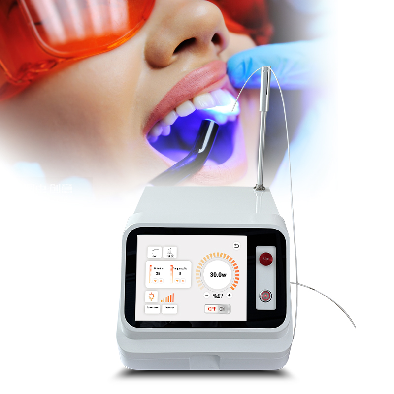 2024 Hot Sale Dental Soft Tiss - огляд і ціна Teeth Whitening With Laser