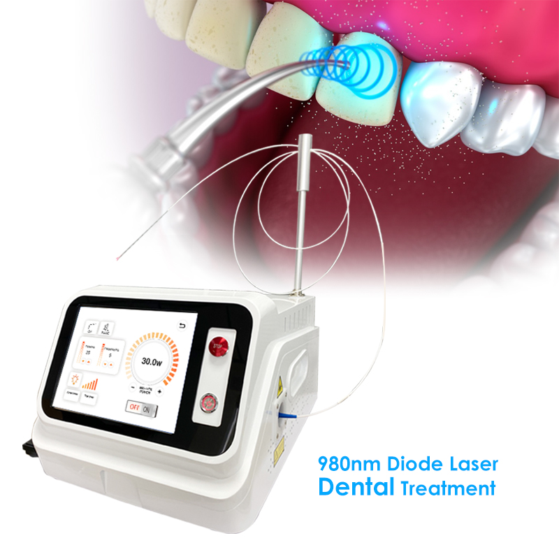 2024 Hot Sale Dental Soft Tiss - огляд і ціна Teeth Whitening With Laser