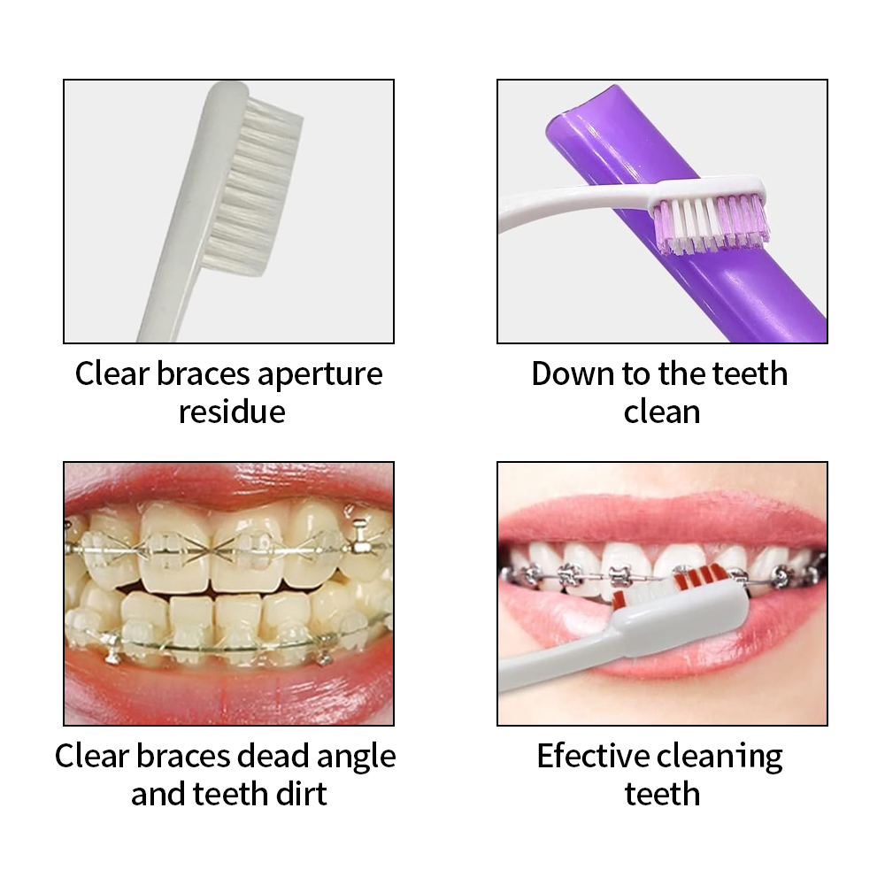 8Pcs/set Orthodontic Dental Ca - огляд і ціна Teeth Whitening Brush