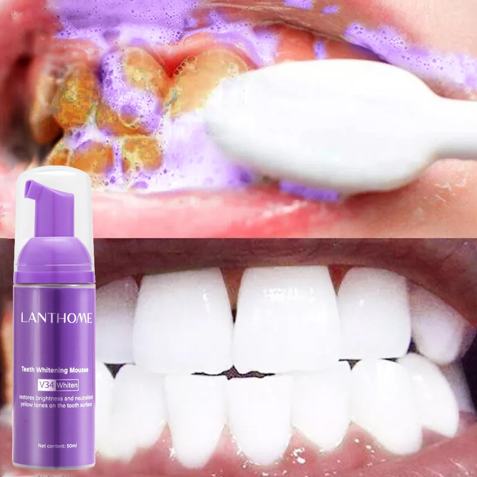 V34 Mousse Teeth Cleaning Toot - огляд і ціна Teeth Whitening Yellow Teeth