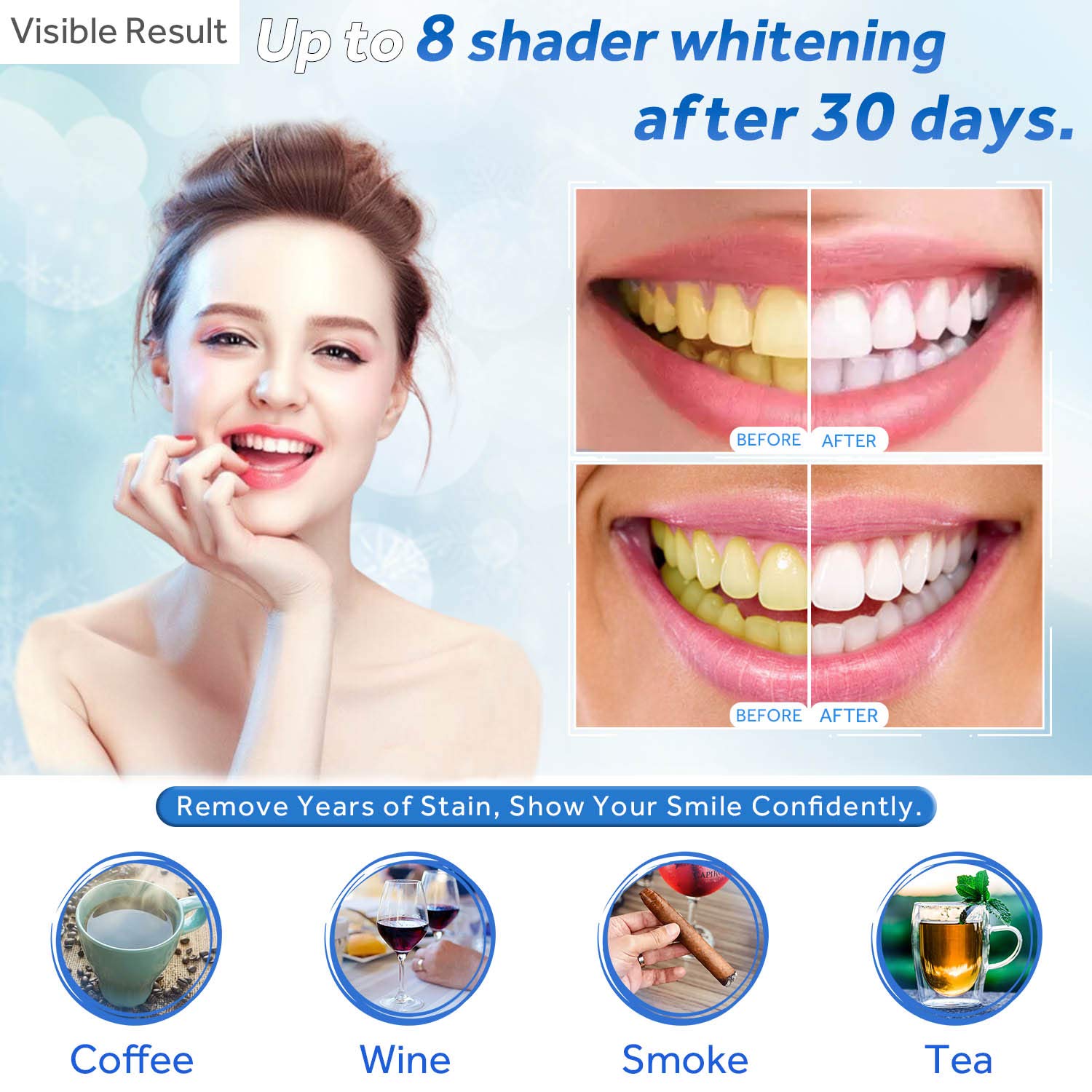 Teeth Whitening Gel Refill Syr - огляд і ціна Teeth Whitening Singapore