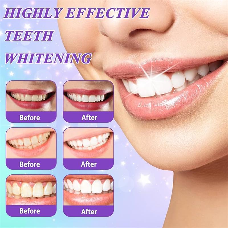 9D Purple Teeth Whitening Toot - огляд і ціна Teeth Whitening Yellow Teeth