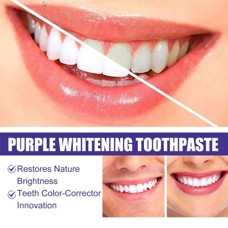 9D Purple Teeth Whitening Toot - огляд і ціна Teeth Whitening Yellow Teeth