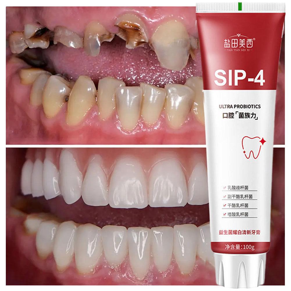 100g Sip-4 Probiotic Whitening - огляд і ціна Teeth Whitening Yellow Teeth