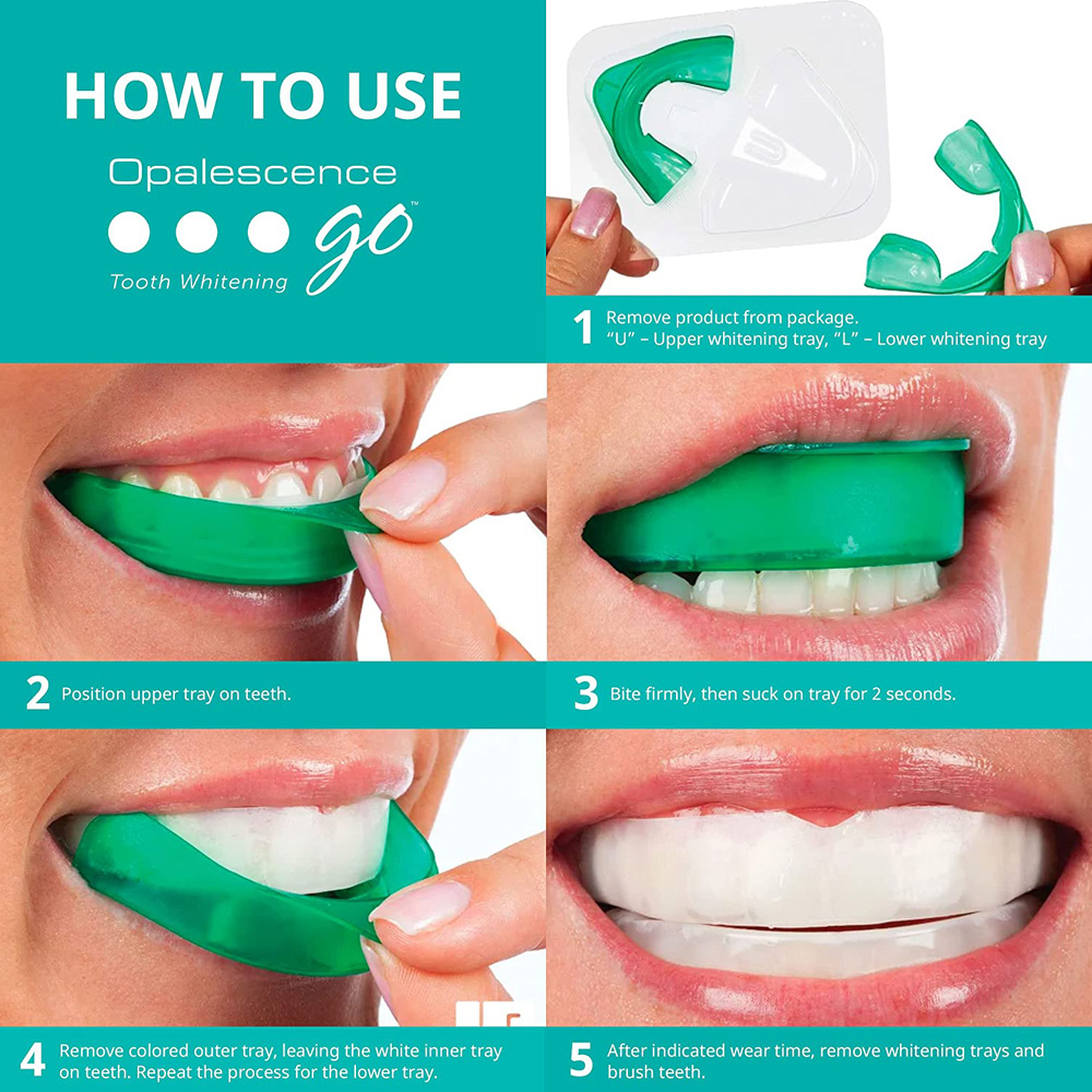 Opalescence Go Whitening Trays - огляд і ціна Teeth Whitening Opalescence