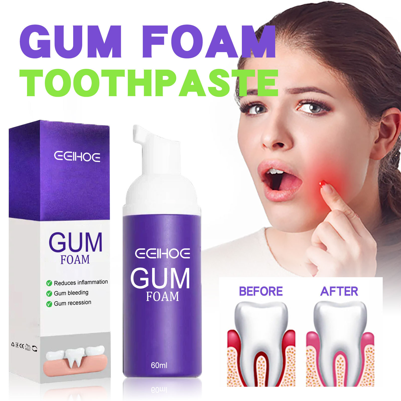 60ml Teeth Whitening Mousse V3 - огляд і ціна Teeth Whitening Yellow Teeth