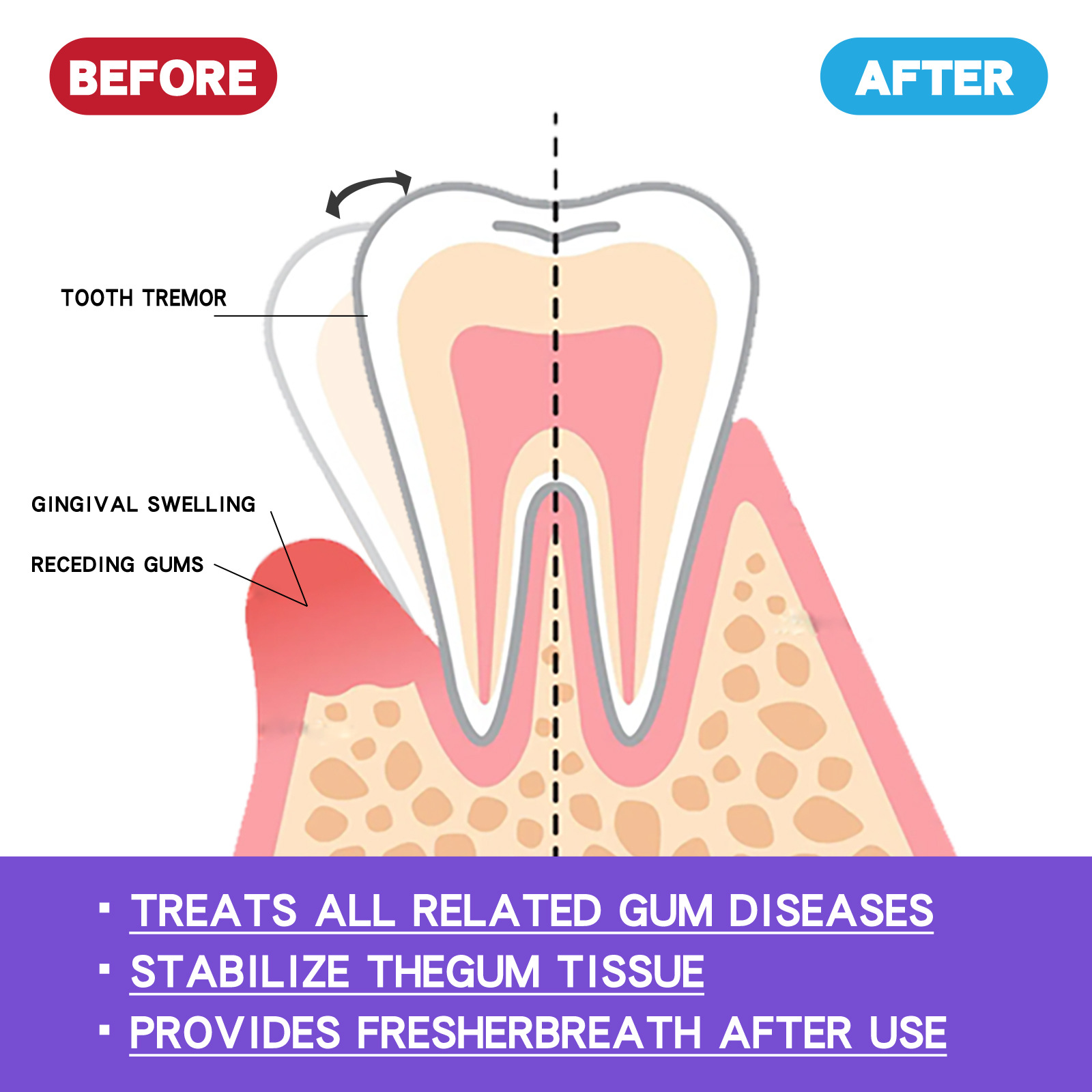 60ml Teeth Whitening Mousse V3 - огляд і ціна Teeth Whitening Yellow Teeth