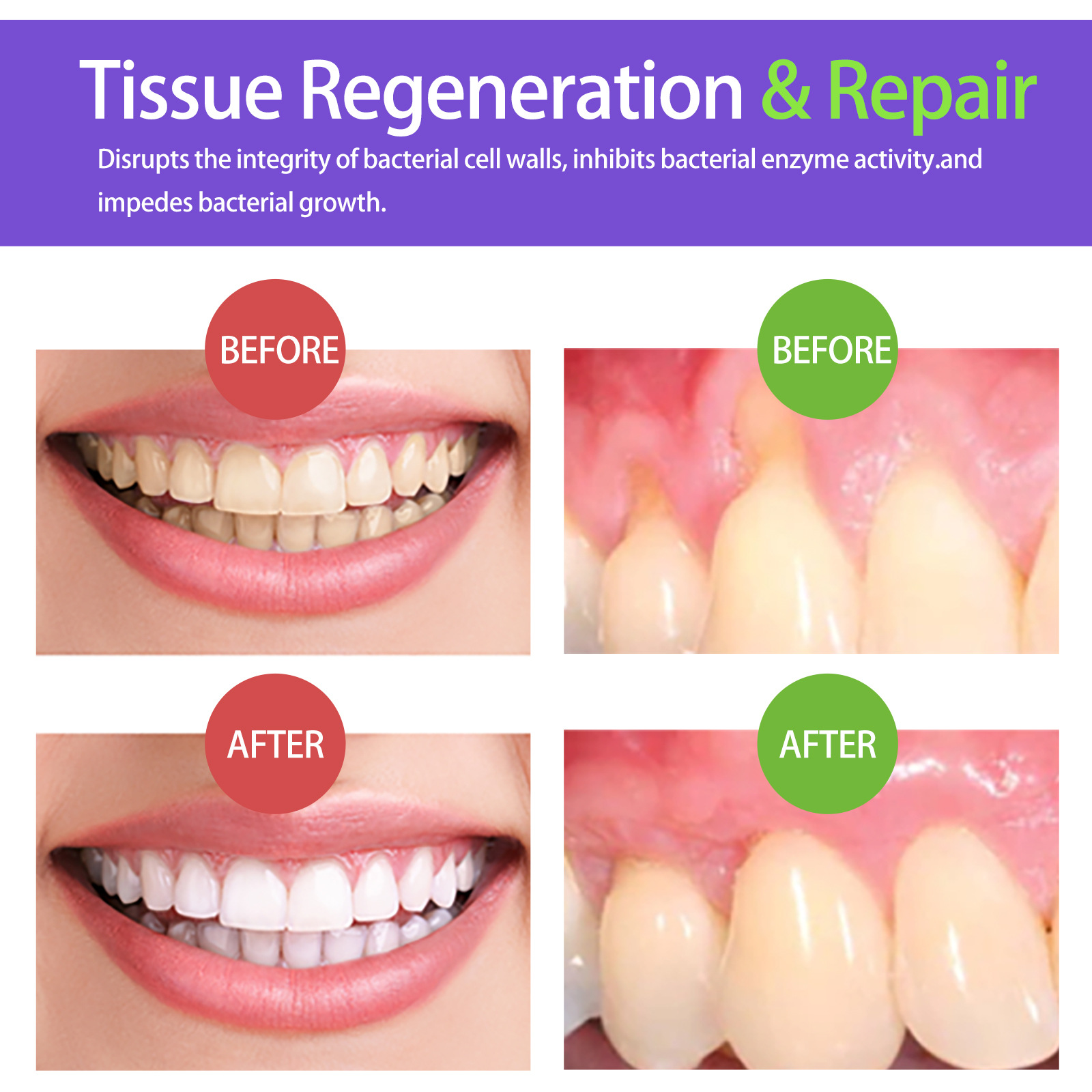 60ml Teeth Whitening Mousse V3 - огляд і ціна Teeth Whitening Yellow Teeth