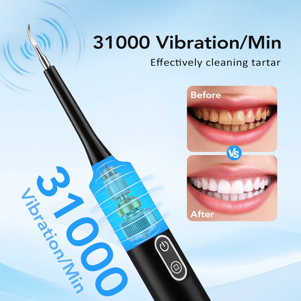 Electric Sonic Vibration Denta - огляд і ціна Teeth Whitening And Stain Removal